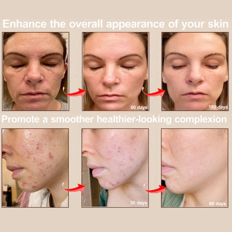 Revitalize Your Skin with the 7-Color Photon Facial LED Mask - Anti-Aging Red Light Therapy for Face and Neck